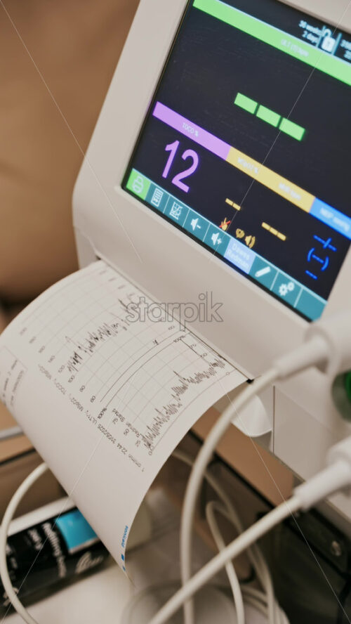 Chisinau, Moldova – May 31, 2025: Close-up of a fetal monitor in a doctor’s office, displaying fetal heart rate and uterine contraction data during a prenatal check-up. Vertical - Starpik Stock