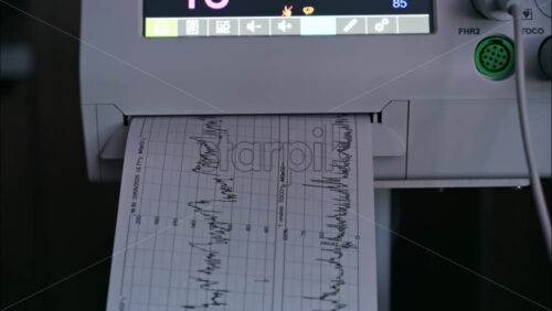 Close-up of a fetal monitor in a doctor’s office, displaying fetal heart rate and uterine contraction data during a prenatal check-up - Starpik Stock