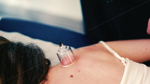 Video - Close up of vacuum cupping therapy being applied to a woman's upper back in a clinical wellness setting