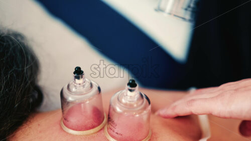 Video - Close up of vacuum cupping therapy being applied to a woman's upper back in a clinical wellness setting