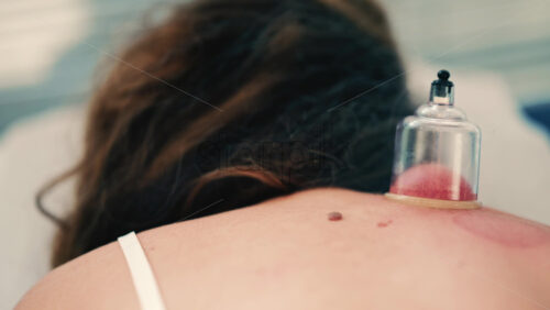 Video - Close up of vacuum cupping therapy being applied to a woman's upper back in a clinical wellness setting